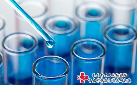 荨麻疹不需要抽血