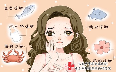 女性荨麻疹病因,女人长荨麻疹的原因