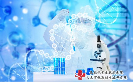 白癜风病因,白癜风为什么增多