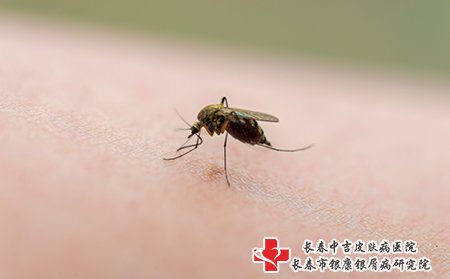 蚊虫叮咬也会皮肤瘙痒