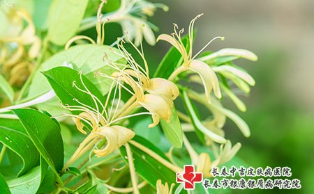 金银花 可以治疗痤疮