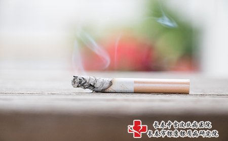 痤疮尽量不用抽烟