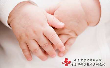 宝宝皮肤瘙痒可能是过敏