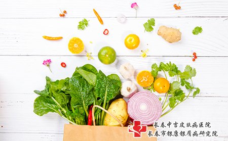 雀斑可以通过饮食治疗