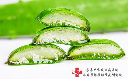 芦荟治疗雀斑只能辅助治疗