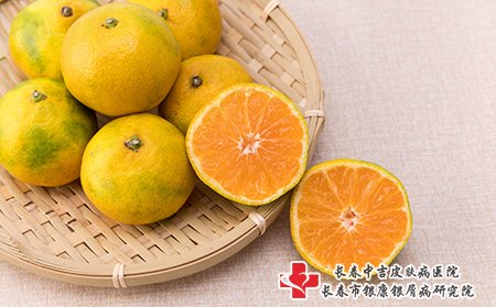 荨麻疹患者可以吃橙子
