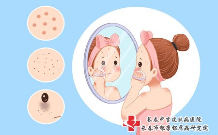 儿童雀斑预防,怎样预防儿童雀斑