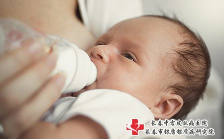 牛皮癣在哺乳期要注意