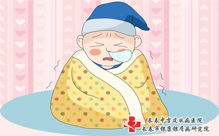 男性牛皮癣怎么办,男性患牛皮癣怎么办