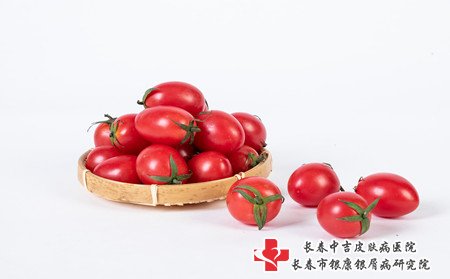 雀斑遗传吗,雀斑是不是遗传病