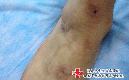 皮肤瘙痒图片