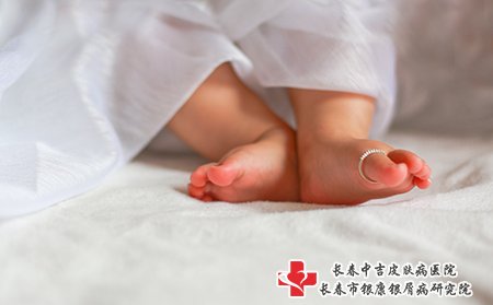 宝宝皮炎会感到瘙痒