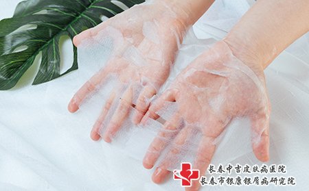 痤疮可以适当敷面膜