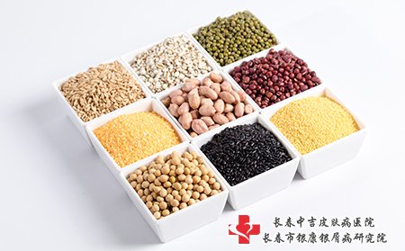 白癜风患者要合理饮食