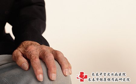 老人皮肤瘙痒的原因有很多